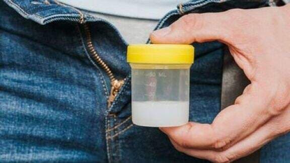 Dokter Boyke Kuak Manfaat Cairan Pria untuk Wajah, Salah Satunya Bikin Wanita Terlihat Awet Muda!