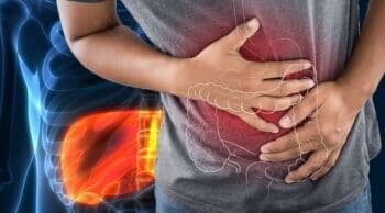 6 Penyebab Kanker Liver, Penyakit yang Diidap Adik Tessa Kaunang Sebelum Meninggal