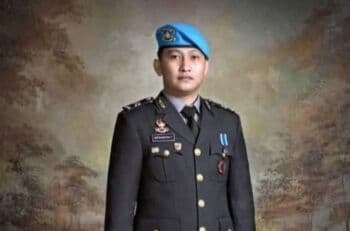 Otak Brigadir J Pindah ke Perut, Ini Penjelasan Dokter Forensik