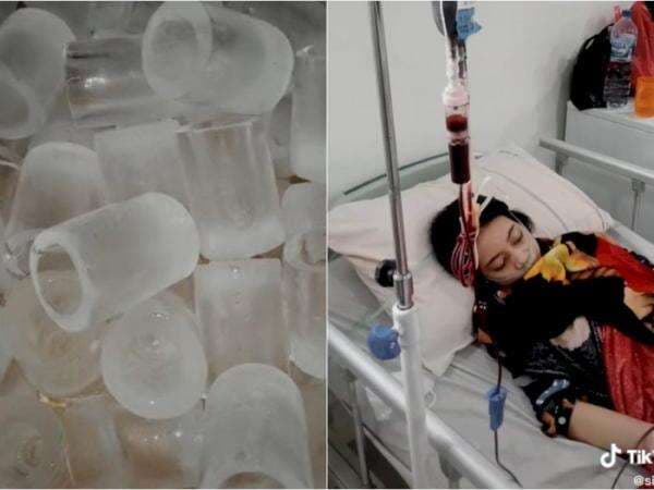 Wanita Ini Diduga Kena Anemia Gara-gara Sering Ngemil Es Batu, Begini Penjelasan Dokter
