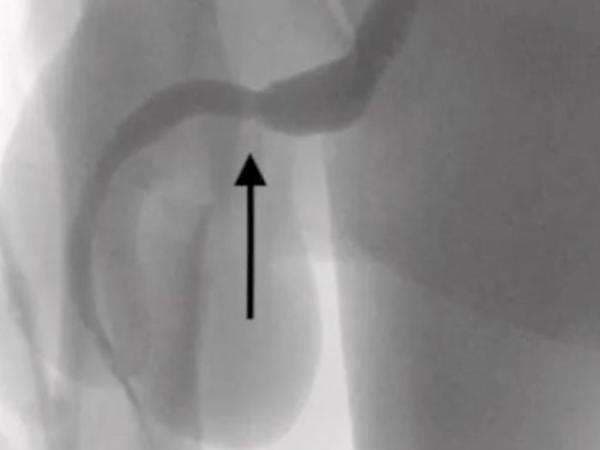 Remaja 15 Tahun Masukkan Kabel USB ke Penis, Ngakunya Buat Eksperimen Seksual