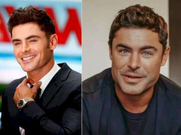 Bentuk Wajah Aktor Zac Efron Berubah, Dagunya 'Goyang' karena Hantam Granit