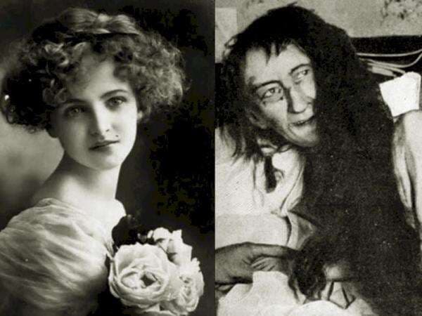 Kisah Pilu Blanche Monnier: 25 Tahun Dikurung Ibu Sendiri Gara-gara Terlalu Cantik