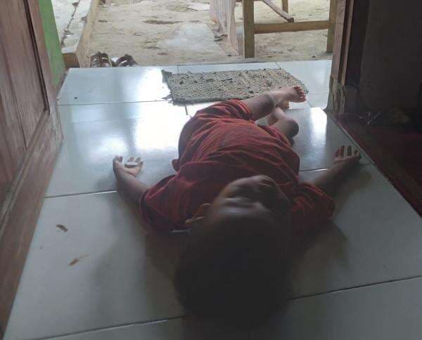 Menyayat Hati! Tak Bisa Berjalan Sejak Lahir, Balita Asal Labuan ini Butuh Uluran Tangan