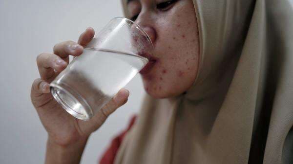 Wajah Kamu Beruntusan Akibat Skincare? Begini Cara Mengatasinya