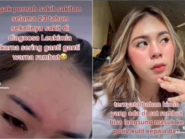 Wanita Ini Didiagnosa Leukemia Gara-gara Sering Cat Rambut, Sampai Nyesal