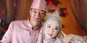 Biodata dan Profil Surya Manurung: Umur, Agama dan Riwayat Penyakit, TikToker Viral Nikahi Gadis Cantik