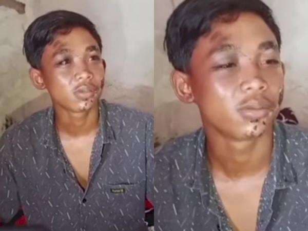 Kesaksian Korban Kanjuruhan, Sedih! Niat Mau Pulang Malah Kena Semprot Gas Air Mata