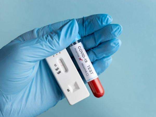 WHO Peringatkan Pandemi Belum Berakhir usai Varian Omicron XBB Picu Lonjakan COVID-19