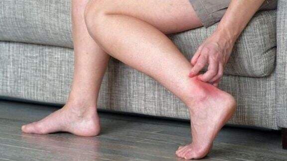 Jangan Abaikan! Kesemutan Bisa Jadi Tanda Kamu Mengidap Diabetes Lho, Ini 7 Tanda Lainnya yang Muncul di Kaki