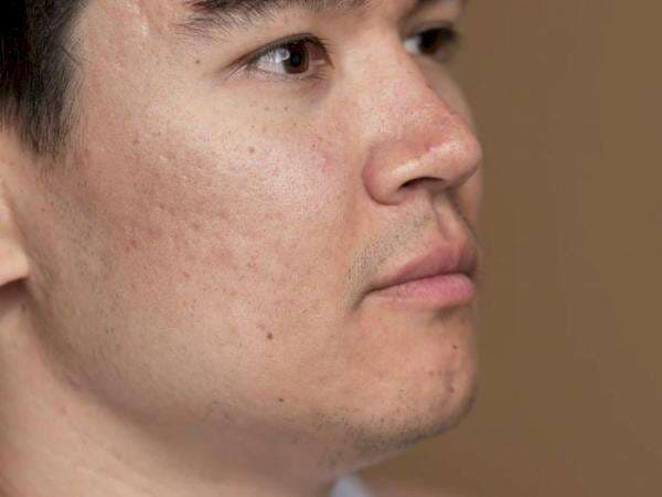 5 Cara Mengecilkan Pori-pori Wajah Paling Efektif, Lakukan Rutin! 5 Cara Mengecilkan Pori-pori Wajah Paling Efektif, Lakukan Rutin!