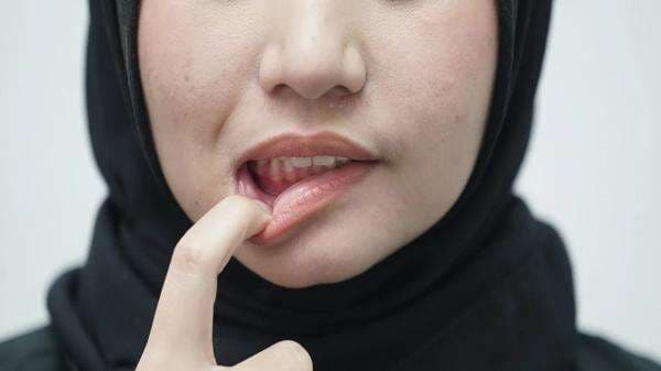 Punya Karang Gigi? Coba Hilangkan Pakai Garam, Manjur Banget