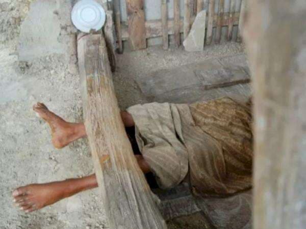 Dampak Negatif Bagi Orang yang Dipasung, Tradisi yang Masih Belum Hilang di Indonesia