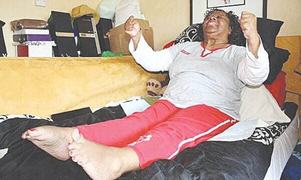 Satu Banding Satu Juta Kemungkinan, Stiff Person Syndrome Adalah Penyakit Langka di Dunia