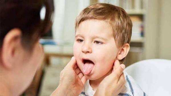 Kenali Gejala Demam Scarlet pada Anak