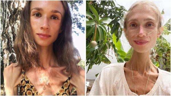 Heboh Bule Polandia Ditemukan Meninggal Dunia di Bali setelah Diet Ekstrem