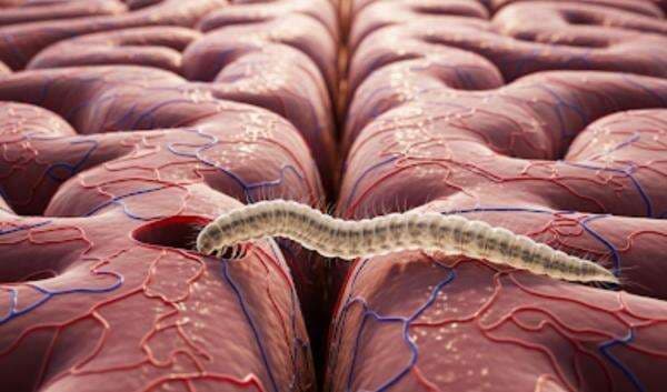 Ngeri! Begini Cara Cacing Masuk ke Otak dan Menghisap Darah Manusia Ngeri! Begini Cara Cacing Masuk ke Otak dan Menghisap Darah Manusia