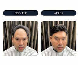 Tutupi Kebotakan, Tren Cowok Pakai Toupee Modern Makin Naik Daun