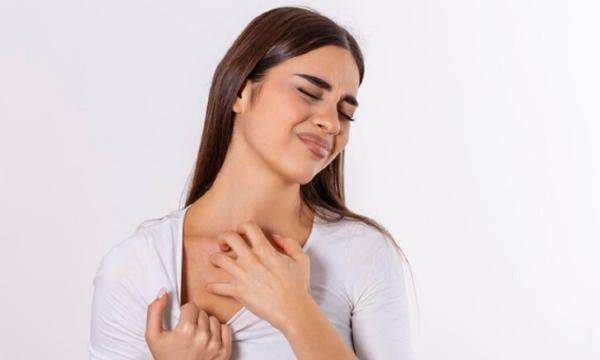 Kulit Sering Gatal saat Hujan? Ini 5 Cara Mengatasinya