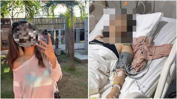 Geger! Turis Muda Meninggal Dunia di Bali Diduga Keracunan Kutu Busuk