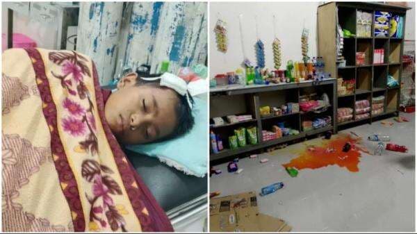 Gempa M4.6 Guncang Buton Utara, Bocah 11 Tahun di Kambowa Luka Tertimpa Reruntuhan Rumah