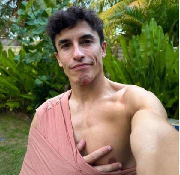 Update Kondisi Marc Marquez Usai Ditabrak Marco Bezzecchi di MotoGP Mandalika 2025