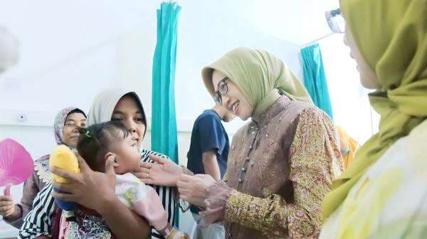 RSNU Permata Lumajang Gelar Operasi Bibir Sumbing Gratis bagi Warga Prasejahtera