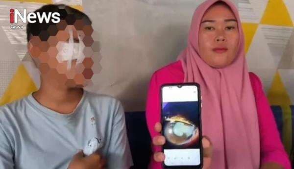 Mediasi Gagal! Ibu Korban Tolak Rp2 Juta, Kasus Mata Buta Akibat Tusuk Bakso Ditangani Polres Gowa
