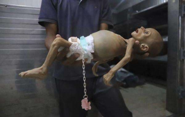 Max Planck Sebut 100.000 Warga Gaza Tewas akibat Serangan Israel, Ini Perinciannya