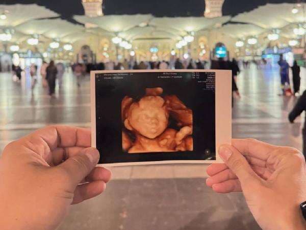 Innalillahi, Anak ke-4 Rizal Armada Meninggal Dunia dalam Kandungan