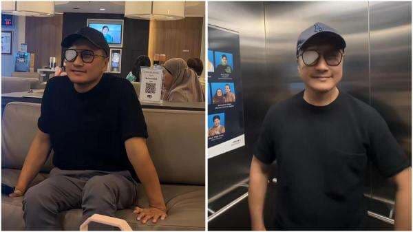 Arie Untung Tiba-Tiba Dilarikan ke Rumah Sakit dengan Mata Diperban, Ini Penyebabnya! 