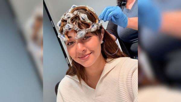 Aurelie Moeremans Gegar Otak, Mohon Doa Jelang Jalani MRI