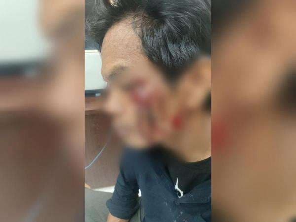 Kronologis Pedagang Es Krim Diduga Dikeroyok Oknum Satpol PP di Alun-Alun Lumajang Kronologis Pedagang Es Krim Diduga Dikeroyok Oknum Satpol PP di Alun-Alun Lumajang