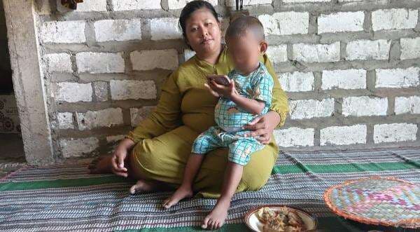 2 Tahun Menunggu Operasi, Balita Tanpa Anus di Bojonegoro Ini Bertahan Hidup dengan Kateter