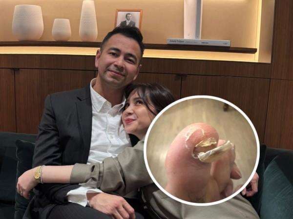 Raffi Ahmad Mendadak Posting Foto Mengerikan, Kuku Sultan Andara Patah!