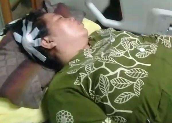 Pertahankan Motor dari Begal, IRT di Lampung Luka Parah Jatuh Tersungkur Pertahankan Motor dari Begal, IRT di Lampung Luka Parah Jatuh Tersungkur