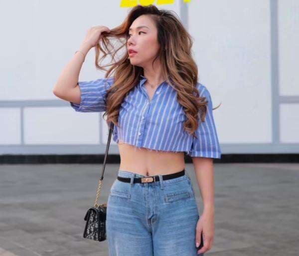 Potret Terbaru Cherly Juno Eks Cherrybelle Usai Jalani Operasi Tummy Tuck