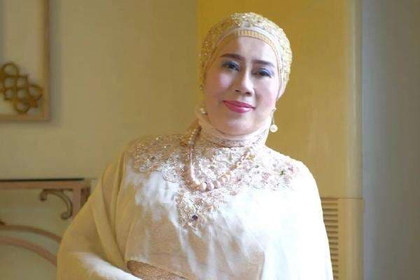 Kronologi Dewi Yull Alami Kebutaan Mata Kanan, Berawal dari Gelembung hingga Retina Lepas