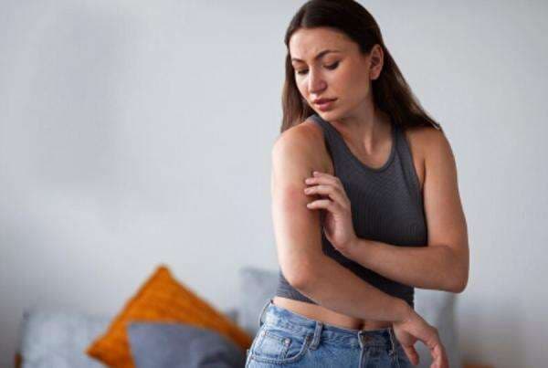 5 Tips Atasi Biduran di Musim Hujan, Anti Gatal-Gatal 5 Tips Atasi Biduran di Musim Hujan, Anti Gatal-Gatal