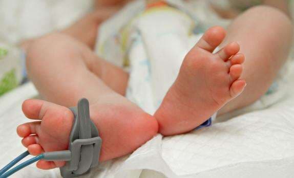 Seorang Ibu Lahirkan Bayi Kembar Empat, Semua Anaknya Meninggal Dunia