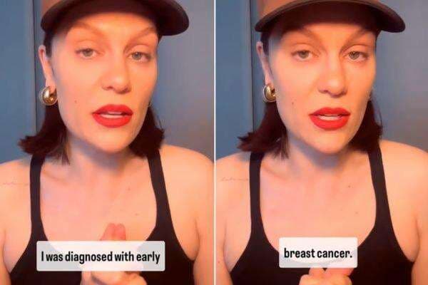 Jessie J Idap Kanker Payudara Stadium Awal, Ini Pentingnya Deteksi Dini