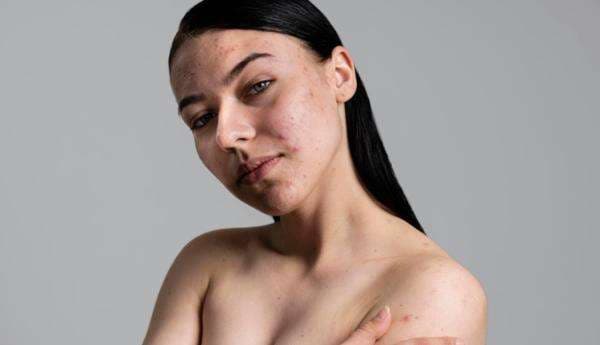 Pakaian Bersih Ternyata Bisa Jadi Penyebab Masalah Kulit, Kok Bisa? Pakaian Bersih Ternyata Bisa Jadi Penyebab Masalah Kulit, Kok Bisa?