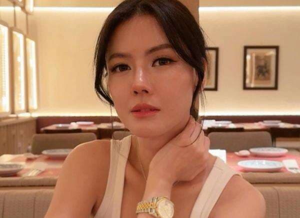 Nita Gunawan Unggah Foto Pakai Tanktop, Netizen Malah Salfok dengan Lebam di Lengan