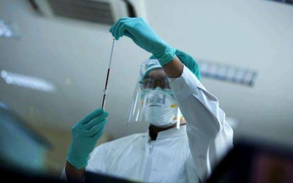 Prodia (PRDA) Anggarkan Rp200 Miliar untuk Buyback Saham