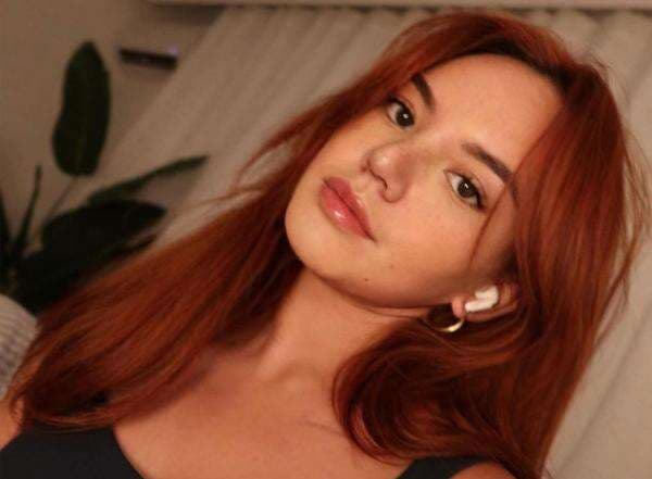 Potret Tetbaru Shafa Harris usai Jalani Operasi Plastik, Makin Cantik Potret Tetbaru Shafa Harris usai Jalani Operasi Plastik, Makin Cantik