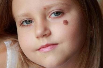 5 Tanda Lahir Orang Kaya yang Jarang Diketahui, Apakah Anda Punya? 5 Tanda Lahir Orang Kaya yang Jarang Diketahui, Apakah Anda Punya?