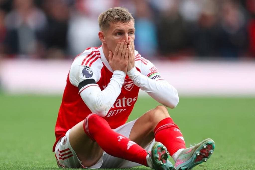 Martin Odegaard Cedera Lagi, Mikel Arteta Pusing jelang Arsenal Lawan Fulham Martin Odegaard Cedera Lagi, Mikel Arteta Pusing jelang Arsenal Lawan Fulham