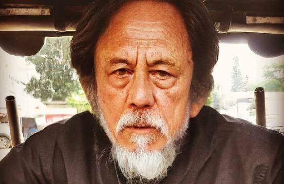 Riwayat Penyakit Epy Kusnandar sebelum Meninggal Dunia, Depresi hingga Kanker Otak Riwayat Penyakit Epy Kusnandar sebelum Meninggal Dunia, Depresi hingga Kanker Otak