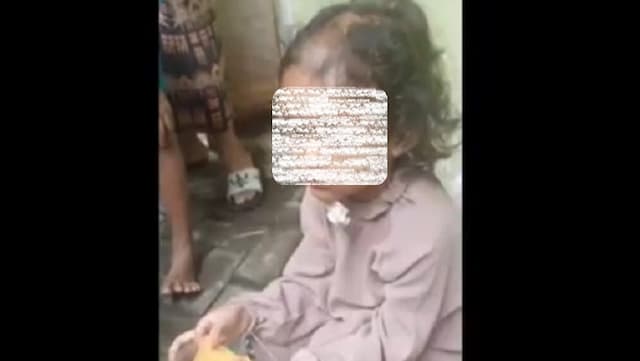 Pilu! Balita Perempuan di Surabaya Diduga Disiksa Paman dan Bibi, Kondisi Mengenaskan Pilu! Balita Perempuan di Surabaya Diduga Disiksa Paman dan Bibi, Kondisi Mengenaskan