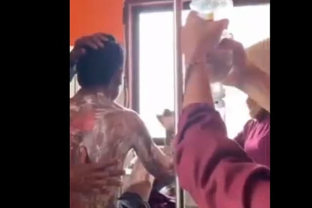 Tolak Cari Rumput, Pemuda di Sumbawa NTB Dibakar Ibu Kandung Tolak Cari Rumput, Pemuda di Sumbawa NTB Dibakar Ibu Kandung